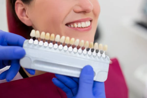 歯科医院の若い女性の歯のホワイトニングのレベルをチェックする歯科医の終わり — ストック写真