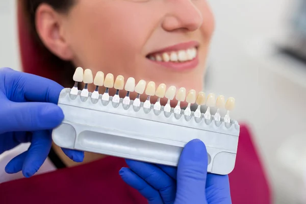Close Dentist Matching Teeth Color Dental Clinic — Stock Photo, Image