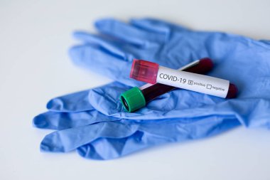 ilaç, sağlık, salgın hastalık ve mikrobiyoloji konsepti - Coronavirus covid-19 kan testi tüpleri ve koruyucu eldivenlere yakın