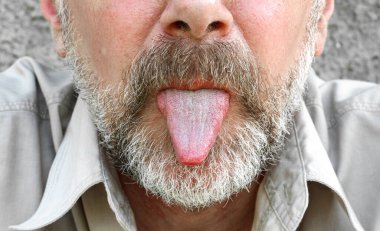 Dili dışarı sarkmış sakallı bir yüz.