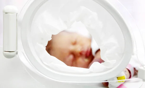 Sliven Bulgarien Januari 2012 Nyfödda Baby Sjukhuset Inkubator — Stockfoto