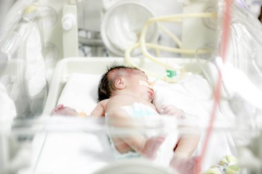 İslimiye, Bulgaristan - 21 Ocak 2012: Yeni doğan bebek hastanede.