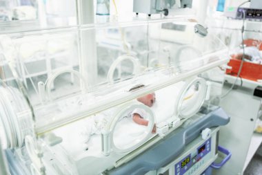 İslimiye, Bulgaristan - 21 Ocak 2012: Yeni doğan bebek hastanede.