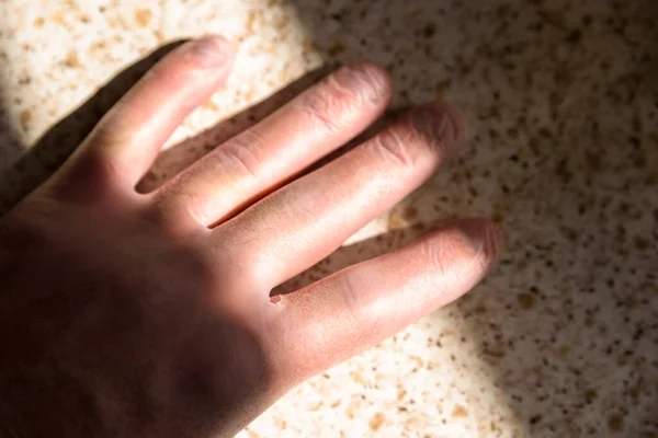 Mão masculina em luvas de borracha sob sol brilhante na cozinha durante o bloqueio covid 19 — Fotografia de Stock