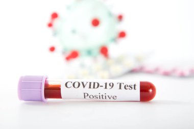 Beyaz zemin üzerinde pozitif COVID-19 testi olan test tüpü