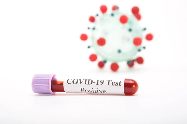 Тестова трубка з позитивним тестом COVID-19 на білому тлі — стокове фото