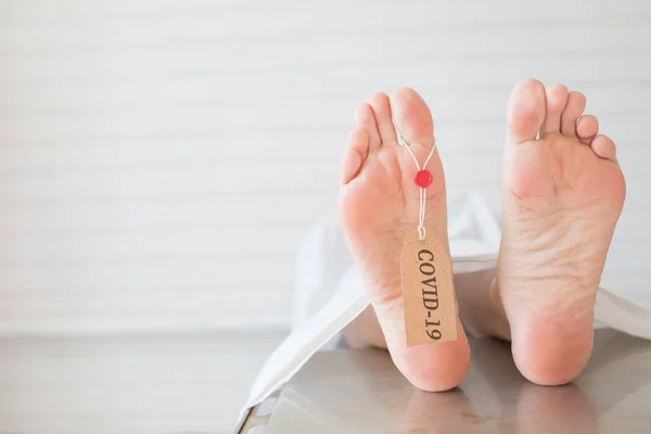 碑文Covid 19付きのタグ付きテーブルの死体の脚 新しいコロナウイルスの流行だ 悲劇と死 ウイルスの流行保護の概念 — ストック写真