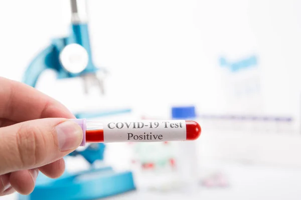 Test Tube Positive Covid Test White Background Virus Pandemic Protection — Stock Photo, Image