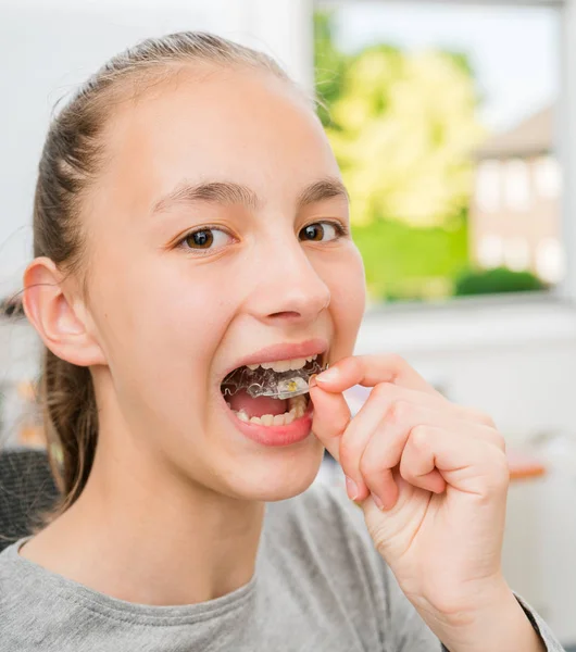 Teenager Braces Her Teeth — Stock Photo, Image