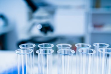 Bilim laboratuvar test tüpleri Loncası Züccaciye Mağazaları