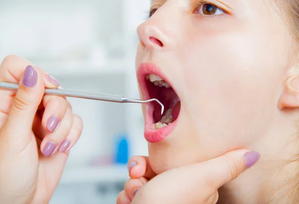 Close-up of little girl opening his mouth wide during treating... — Stock Photo, Image