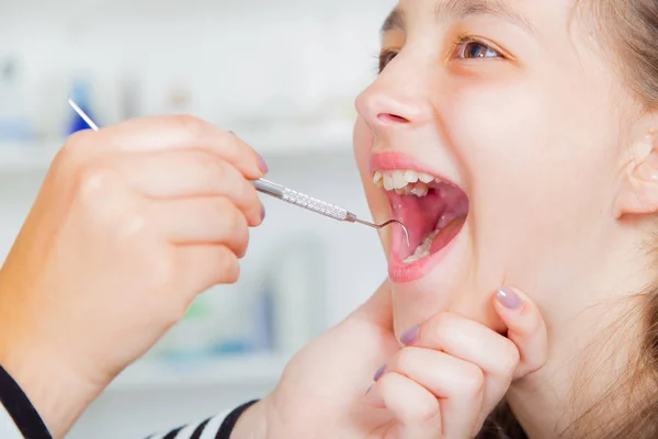 Close Van Meisje Opent Zijn Mond Wijd Tijdens Behandeling — Stockfoto