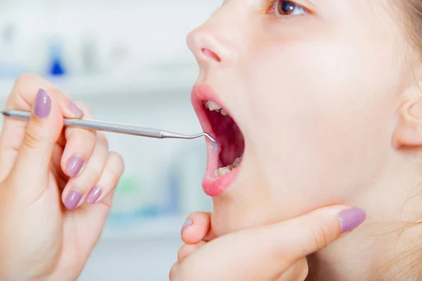 Close Van Meisje Opent Zijn Mond Wijd Tijdens Behandeling — Stockfoto