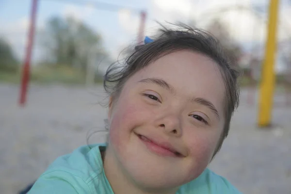 Retrato Baixo Menina Síndrome Sorrindo — Fotografia de Stock