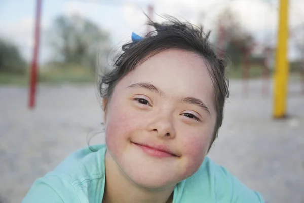 Portret Dziewczyny Zespołem Downa Uśmiechającej Się — Zdjęcie stockowe