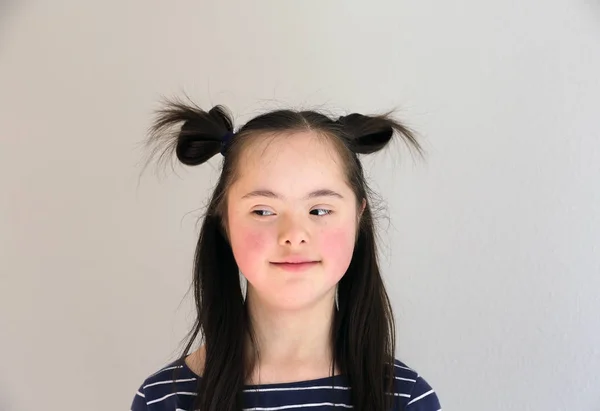 Bonito Sorrindo Para Baixo Menina Síndrome Fundo Cinza — Fotografia de Stock