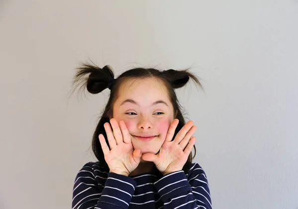 Bonito Sorrindo Para Baixo Menina Síndrome Fundo Cinza — Fotografia de Stock