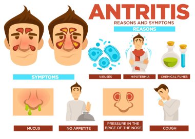 Antritis poster metin vektör ile nedenleri ve belirtileri. Virüsler ve hipotermi, neden olan hastalık kimyasal gazlar. Öksürük balgam ve iştah, burun kemeri, basınç yokluğu. Hastalık özellikleri