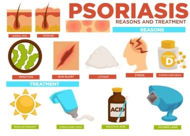 Psoriasis nedenleri ve tedavi poster bilgi vektör ile. Deri yaralanma enfeksiyonu, Lityum veya stres, vücutta D vitamini eksikliği neden olduğu hastalık. Güneş ışığı ile kremler uygulama salisilik asit tedavi