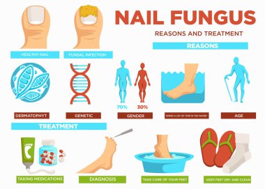 Tırnak mantar nedenleri ve tedavi poster metin vektör ile. Sağlıklı ve mantar enfeksiyonu, dermatofit ve genetik sorunlar, cinsiyet ve nedenleri yaşlanma. İlaç almak, tanı ve temiz ayakları