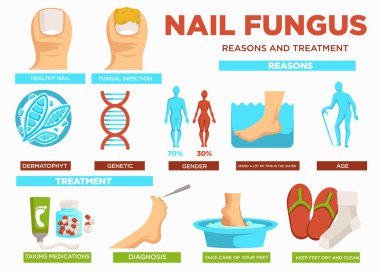 Nail fungus reasons and treatment poster with text vector. Healthy and fungal infection, dermatophyte and genetic problems, gender and aging reasons. Take medication, have diagnosis and clean feet clipart