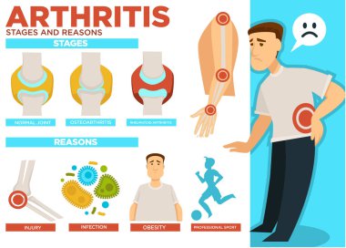 Arthritis stages and reasons of disease poster with text vector. Normal joint, osteoarthritis and rheumatoid arthritis. Injury and infection, obesity and professional sport causing illness of people clipart