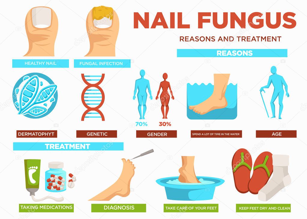 Nail fungus reasons and treatment poster with text vector. Healthy and fungal infection, dermatophyte and genetic problems, gender and aging reasons. Take medication, have diagnosis and clean feet
