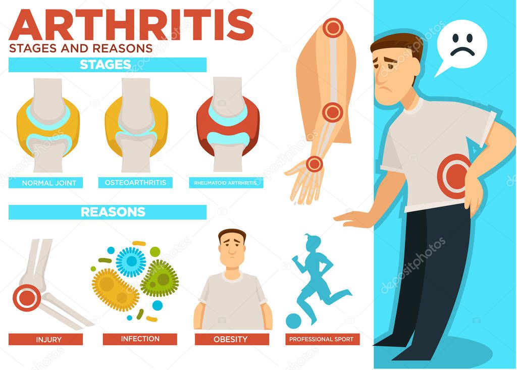 Arthritis stages and reasons of disease poster with text vector. Normal joint, osteoarthritis and rheumatoid arthritis. Injury and infection, obesity and professional sport causing illness of people