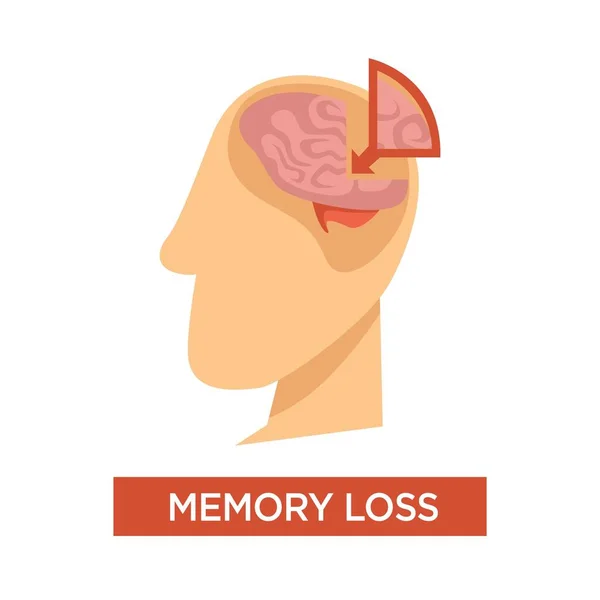 Sclerosis Alzheimers Disease Symptom Memory Loss Isolated Vector Head Medical — Stock Vector