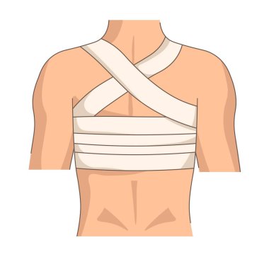 Sırt bandajı yaralanması ya da travma duruşu tıbbi bandaj ilk yardım vektör ağrısı veya ağrı ortopedik araç travmatoloji tıp ve tedavi korse desteği burkulma iyileşme insan vücudu izole.