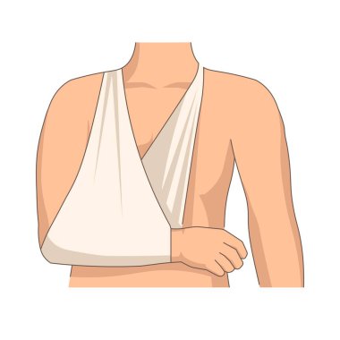 El yaralanması bandajı kırık kol bandajı tıbbı izole edilmiş vektör insan vücudu sağlık ve tedavi kırığı veya kas burkulması ağrısı ilk yardım hastası travması terapisi.