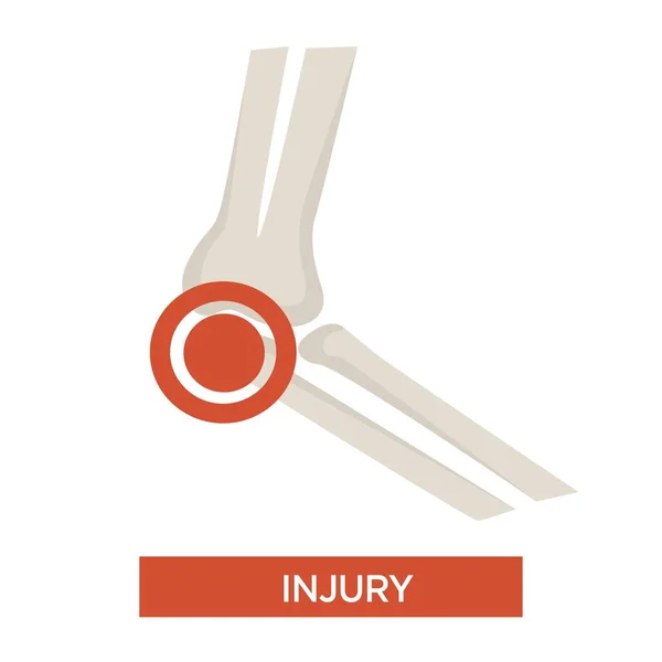 Daño Articular Esqueleto Aislado Parte Lesión Ósea Vector Medicina Reumatología — Archivo Imágenes Vectoriales