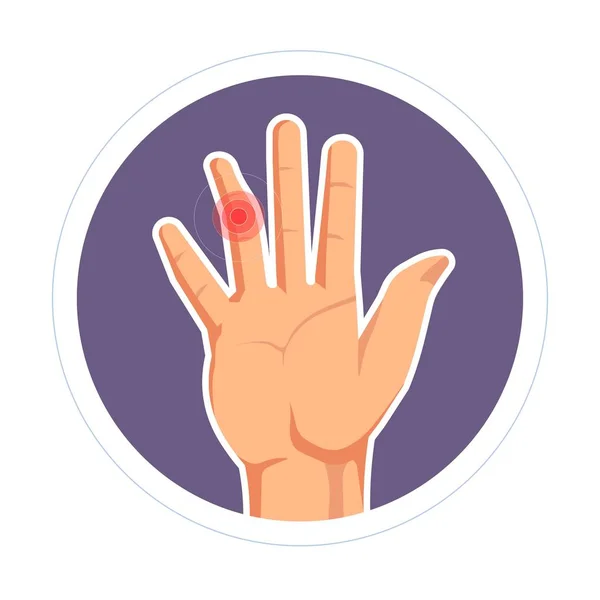 Artritis Reumatoide Luxación Lesión Dedo Vector Humano Aislado Palma Trauma — Archivo Imágenes Vectoriales