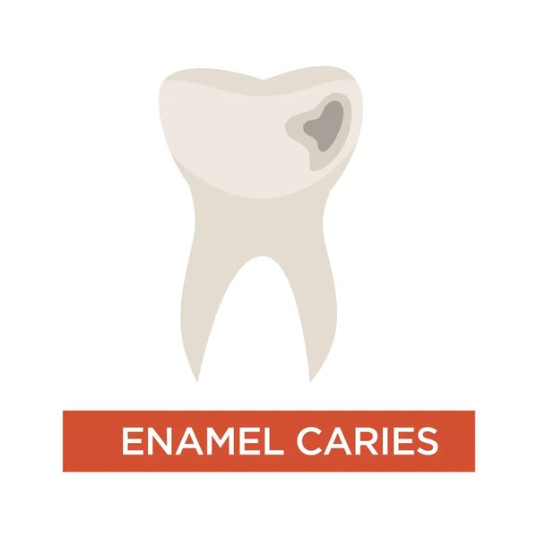 Emalia próchnicy zębów dentystyczny choroba uszkodzenia Stomatologia — Wektor stockowy