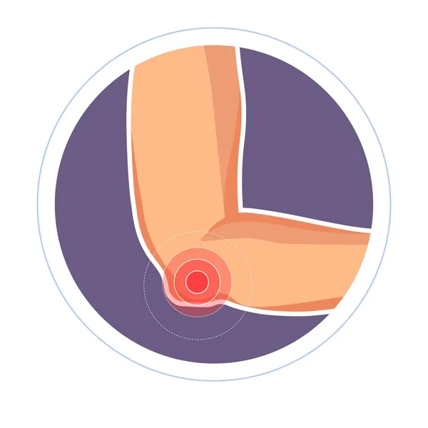 Lesão no cotovelo ícone isolado traumatologia da mão ou braço — Vetor de Stock
