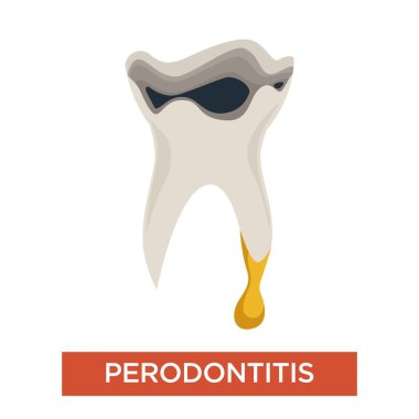 Ağız boşluğu hastalığı periodontitis hasta diş hekimliği izole simge vektör tıp ve tedavi diş ağrısı çürüme diş cerrahisi delik ve irin periodontal ağrı anatomisi hastalık veya hastalık diş bakımı.