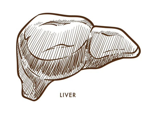 Organ dalam hati terisolasi sketsa cirrhosis atau hepatitis - Stok Vektor