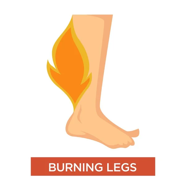 Burning legs symptom with inflamed feet — Stock Vector