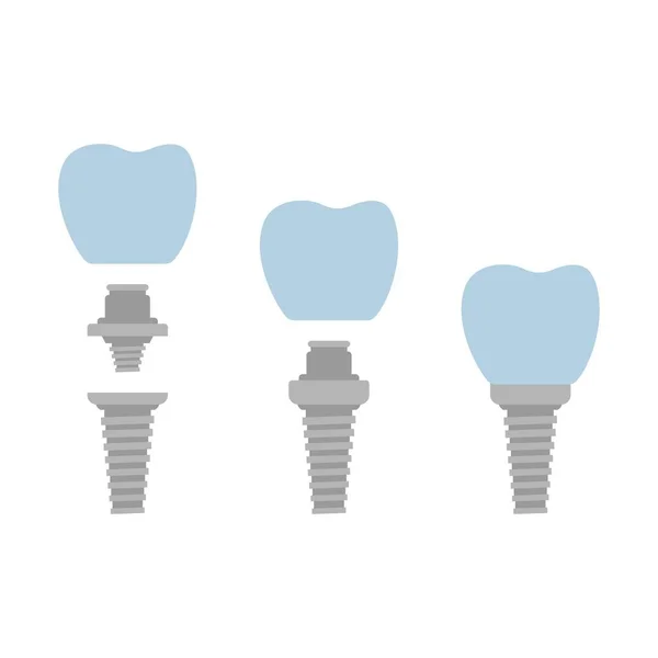 Sistema Implantes Dentales Silueta — Vector de stock
