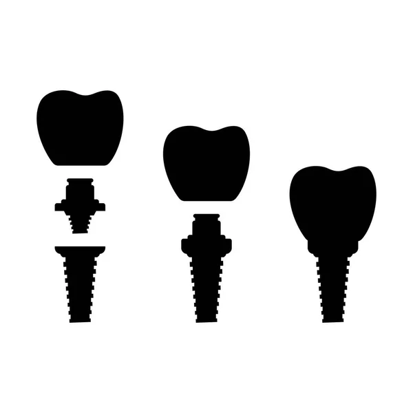 Dental Implant Sistemi Siluet — Stok Vektör