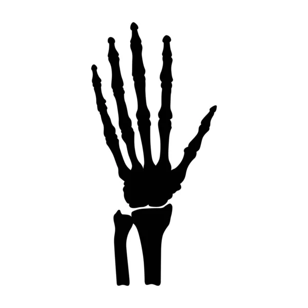 Анатомія Кісток Рук Людини Вектор — стоковий вектор