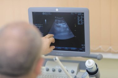 hasta ultrason incelenmesi