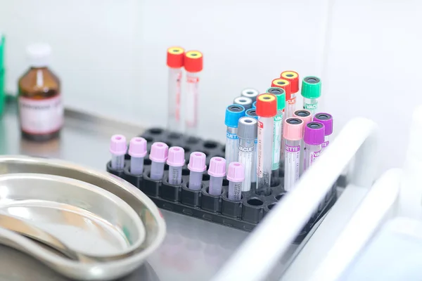 Kan Testi Tüpler Hazırlanması — Stok fotoğraf
