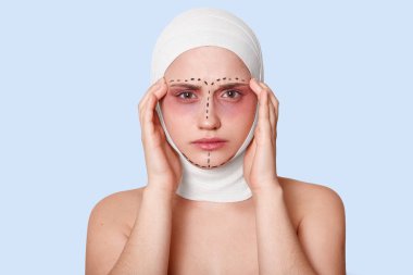 Kozmetik cerrahi sonrası baş ağrısı ve kötü sonuçları olan, tapınaklarda elleri ile poz veren ve mavi arka plan üzerinde izole duran kadın hoşnutsuz genç Avrupalı kadının yatay çekimi.