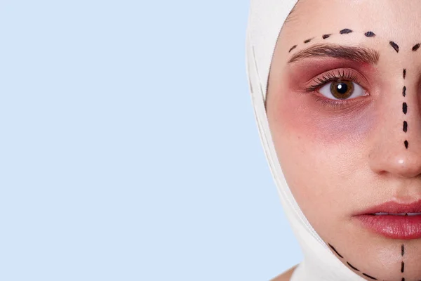 Zbliżenie portret kobiety z linii korekty na twarzy przed operacją chirurgii plastycznej. Połowa twarzy kobiety w klinice kosmetologii, izolowane na niebieskim tle Studio. Koncepcja chirurgii plastycznej. — Zdjęcie stockowe