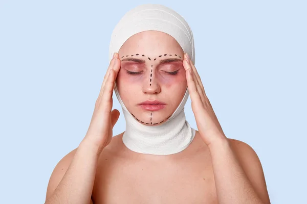 Portrait of beautiful girl in bandage on her head and black correction marks, keeps her hands near temples, suffers from terrible headache after anti aging procedures in cliinic. Cosmetology concept.