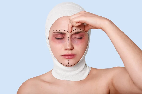 Close up portrait of beautiful young Caucasian woman standing against blue wall with bandage on head, suffers from headache, keeps fingers on forehead, has correction arrows on face. Cosmetic surgary. — Stock Photo, Image