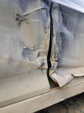 Bir dent tarafı ile mavi acil servis aracı