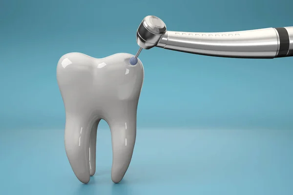 Zbliżenie Widok Wiertarki Dentystycznej Biały Model Zęba Akcji — Zdjęcie stockowe