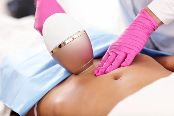Dospělé ženy mají laserové epilace v profesionální kosmetický salon — Stock fotografie